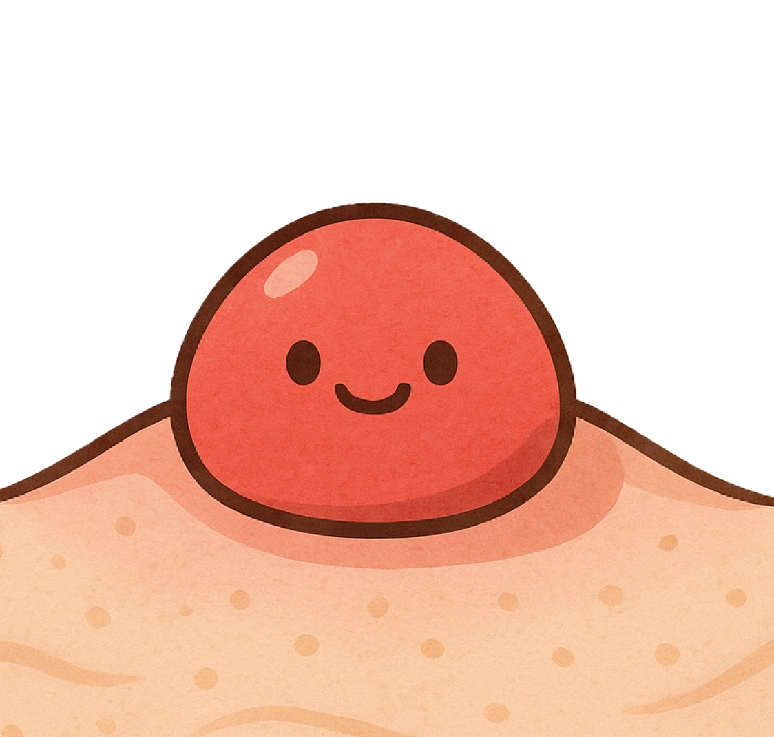 ニキビ